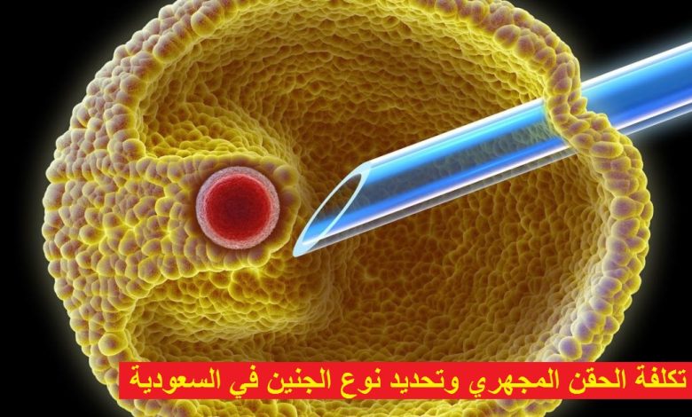 تكلفة الحقن المجهري وتحديد نوع الجنين في السعودية