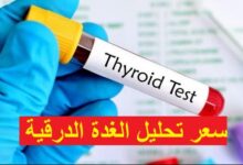 سعر تحليل الغدة الدرقية TSH