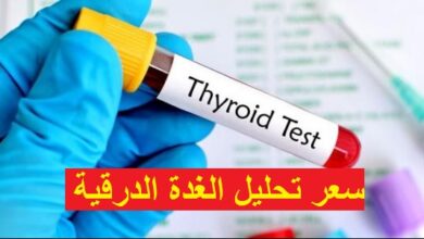 سعر تحليل الغدة الدرقية TSH